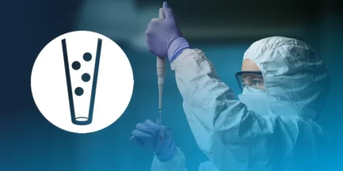 Smart extraction.png